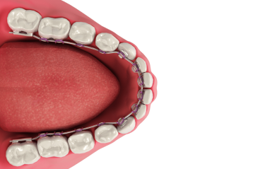 The Ultimate Guide to Orthodontic Treatment for Adults – Orthodontist