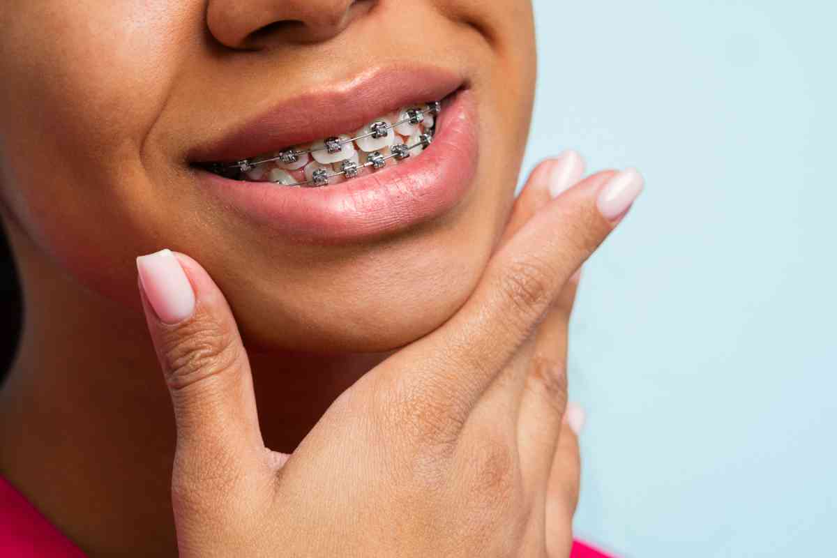 Debunking Common Myths About Orthodontic Treatment Orthodontist