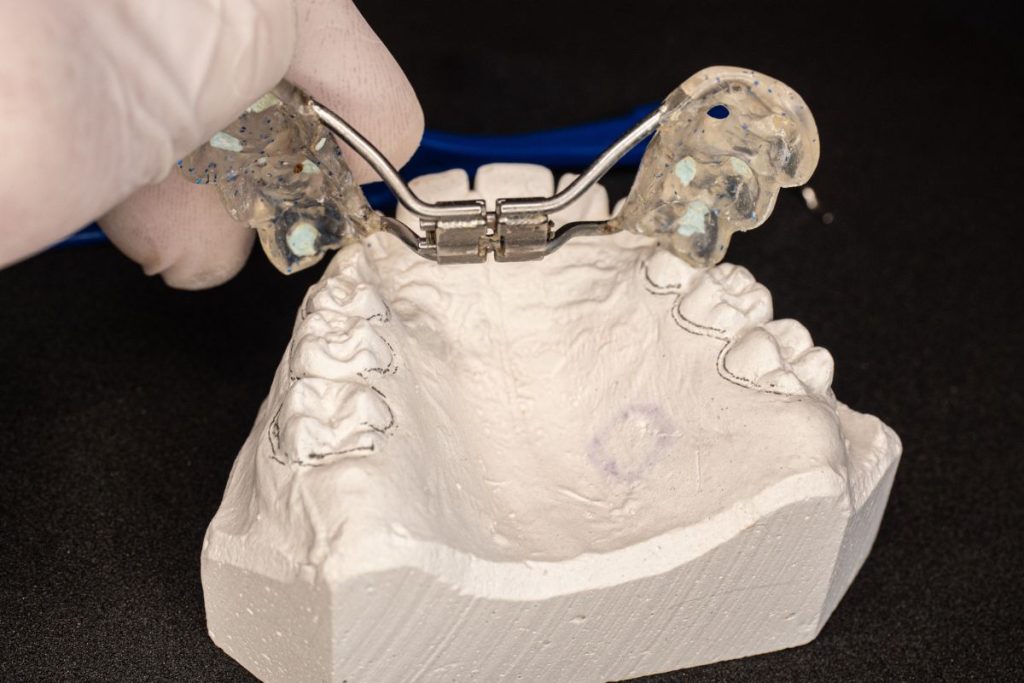 Understanding Palatal Expanders Benefits, Types, and More Orthodontist Toronto Invisalign