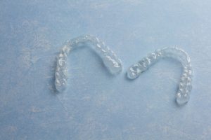 Clear Aligners